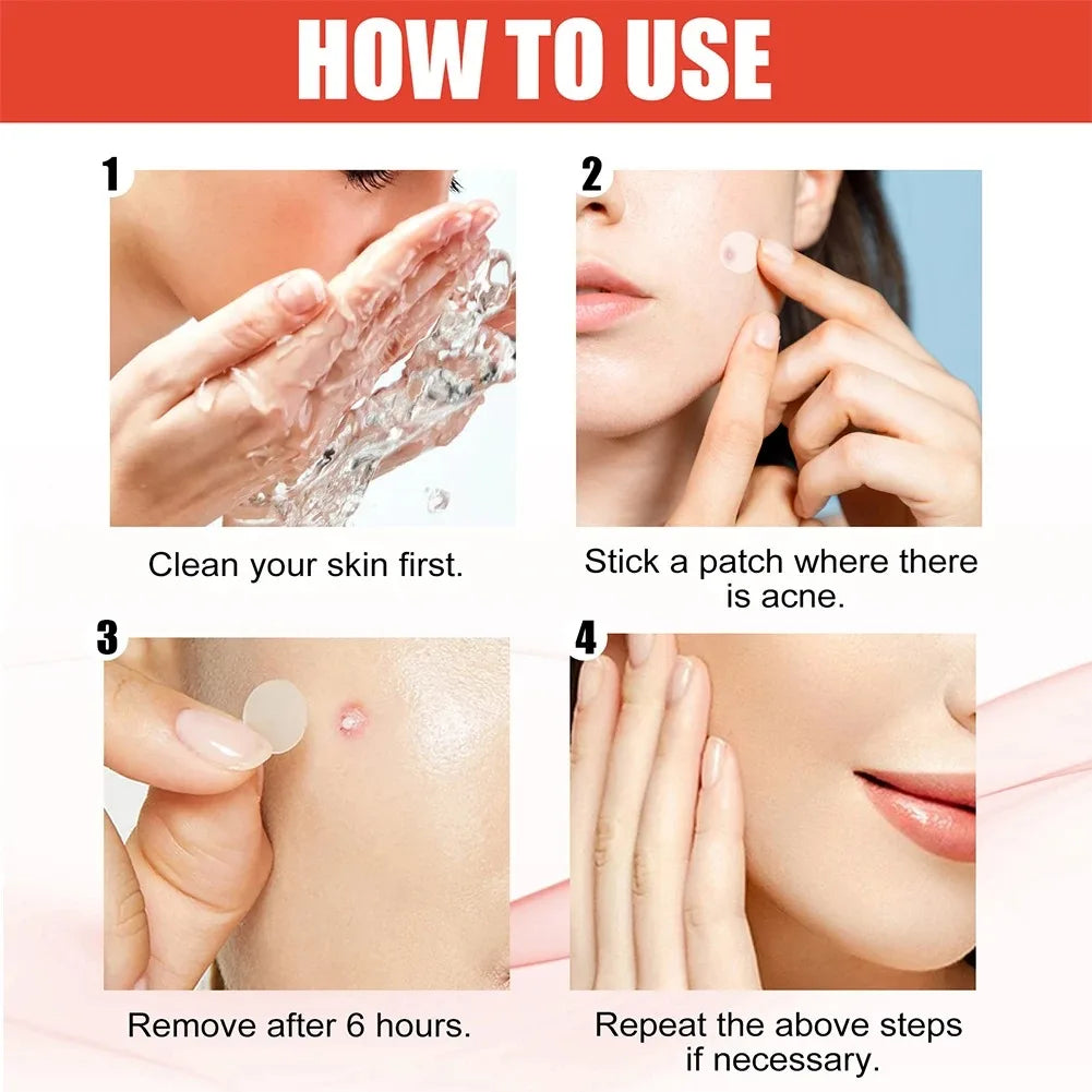 1/2/3 Box Face Acne Patch Invisible Skin Care Pimple Acne Patches Anti-Inflammatory Healing Absorbing Spot Sticker Covering Acne
