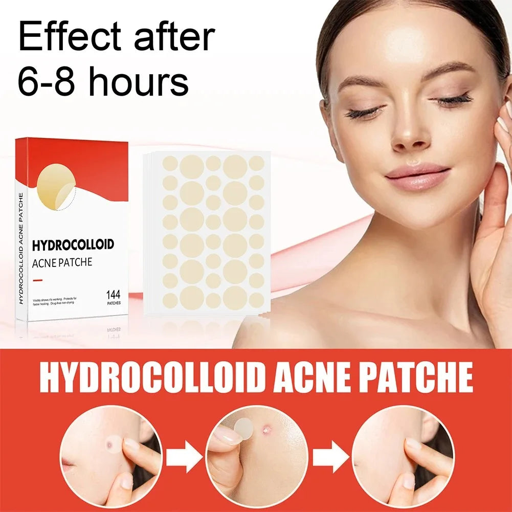1/2/3 Box Face Acne Patch Invisible Skin Care Pimple Acne Patches Anti-Inflammatory Healing Absorbing Spot Sticker Covering Acne