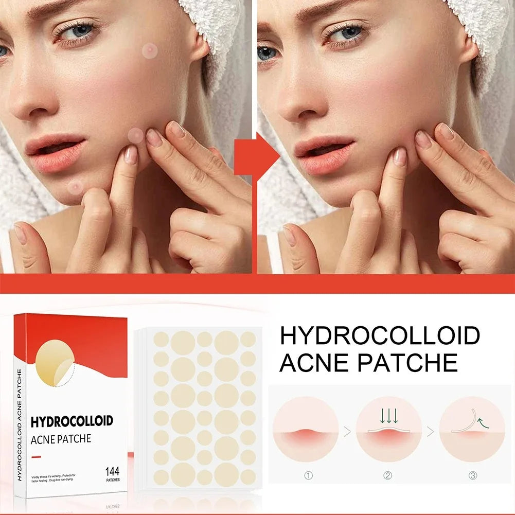 1/2/3 Box Face Acne Patch Invisible Skin Care Pimple Acne Patches Anti-Inflammatory Healing Absorbing Spot Sticker Covering Acne